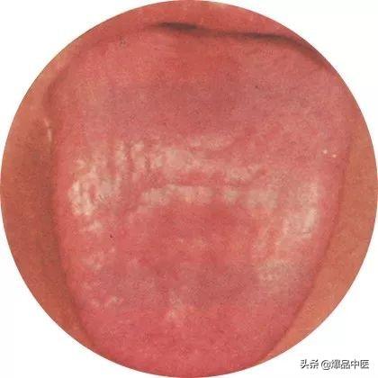 史上最全！高清舌诊图谱