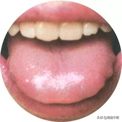 史上最全！高清舌诊图谱