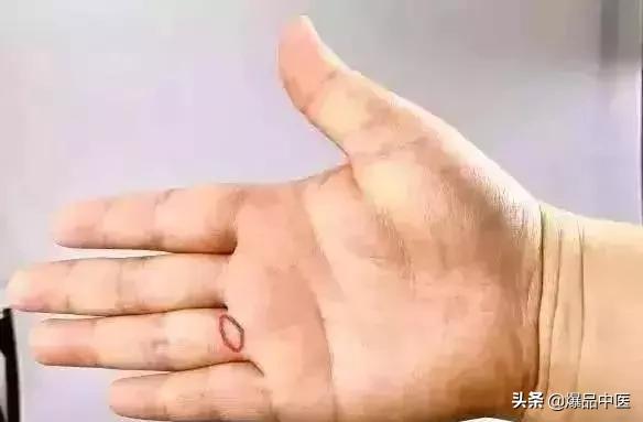 你手上有个“专治各种不通”的穴位