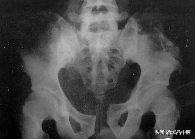 干货 | 110张经典X线片影像诊断