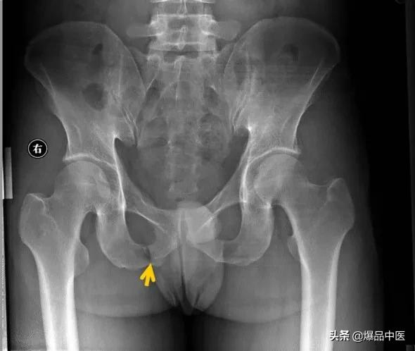 干货 | 110张经典X线片影像诊断