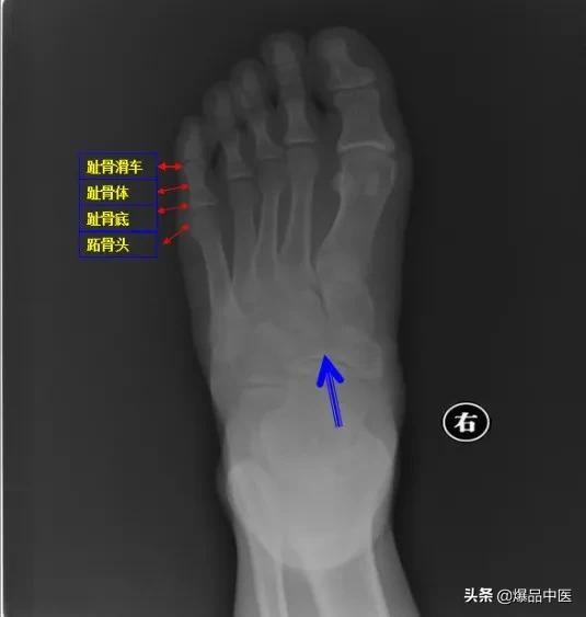 干货 | 110张经典X线片影像诊断