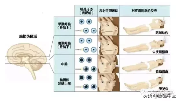 神经系统一天搞定，打破死板记忆方法