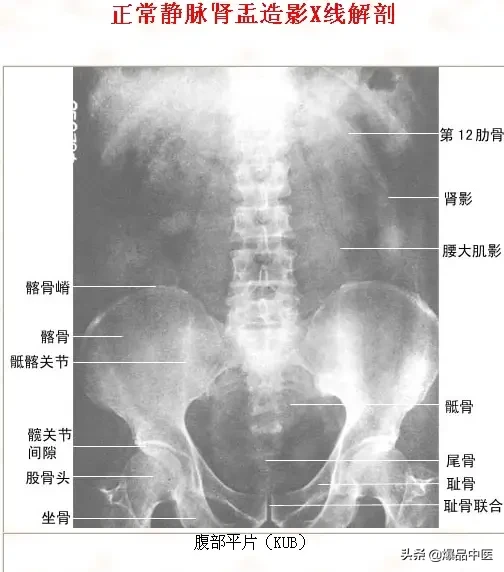 正常Ｘ线解剖