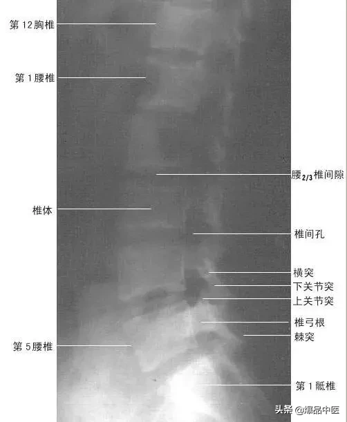 正常Ｘ线解剖