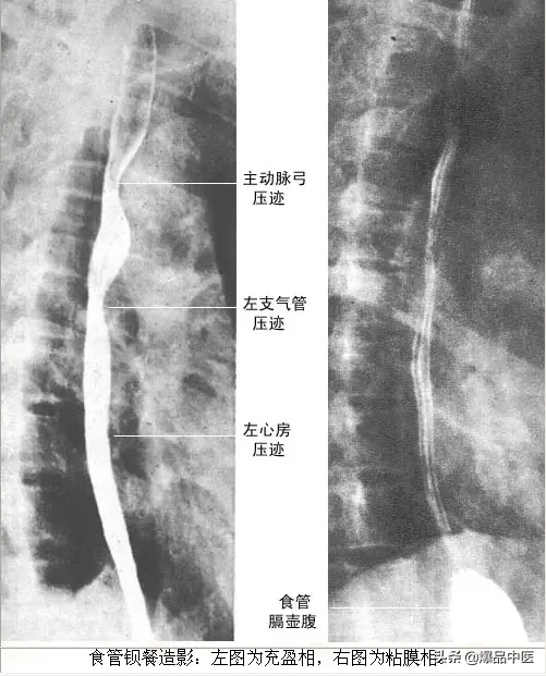 正常Ｘ线解剖