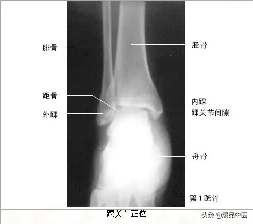 正常Ｘ线解剖