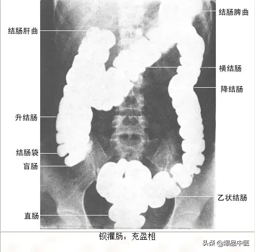 正常Ｘ线解剖