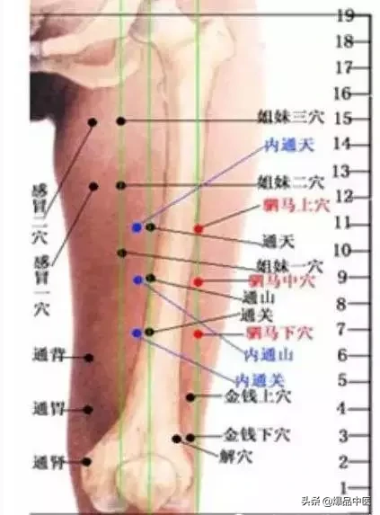 图解董氏七十二绝针，一目了然