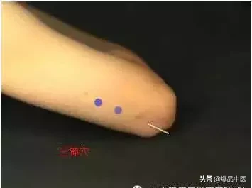 图解董氏七十二绝针，一目了然