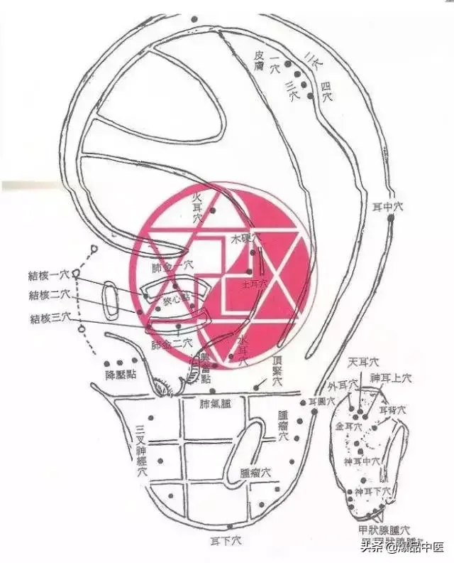 图解董氏七十二绝针，一目了然