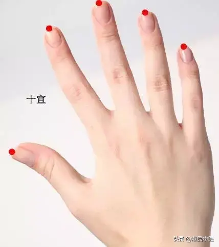 图解88个精选穴，一穴一用