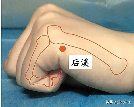 图解88个精选穴，一穴一用