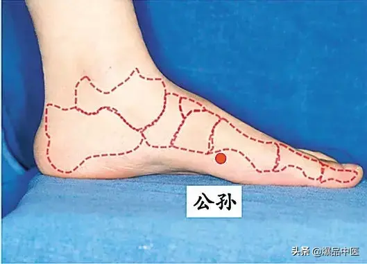 图解88个精选穴，一穴一用