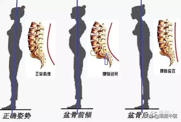 为什么会有高低肩!长短腿?