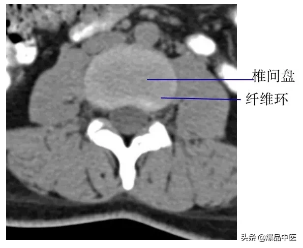 收藏了：脊柱超详细解剖，高清图文版