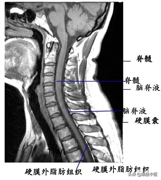 收藏了：脊柱超详细解剖，高清图文版