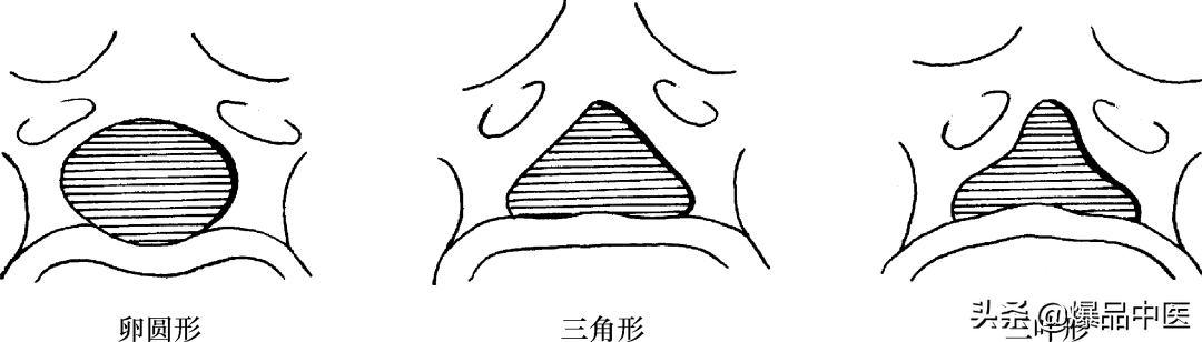 收藏了：脊柱超详细解剖，高清图文版