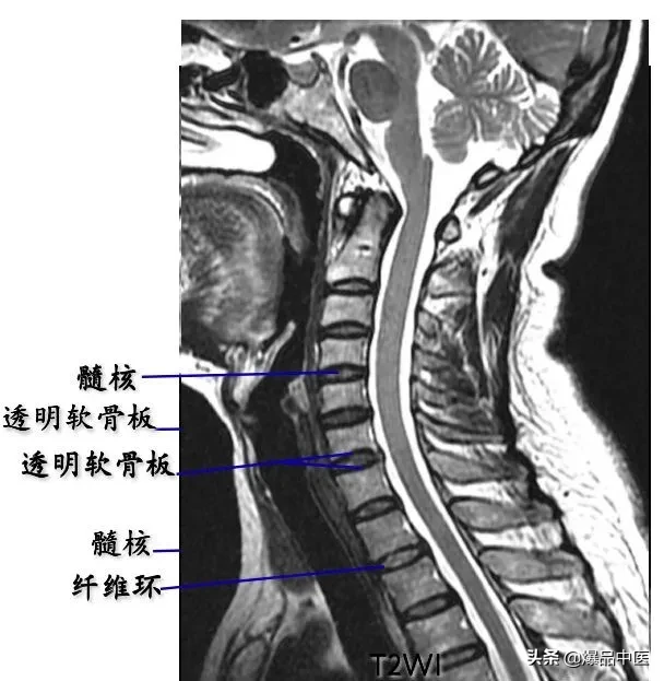 收藏了：脊柱超详细解剖，高清图文版