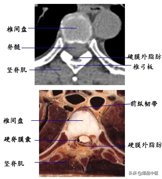 收藏了：脊柱超详细解剖，高清图文版