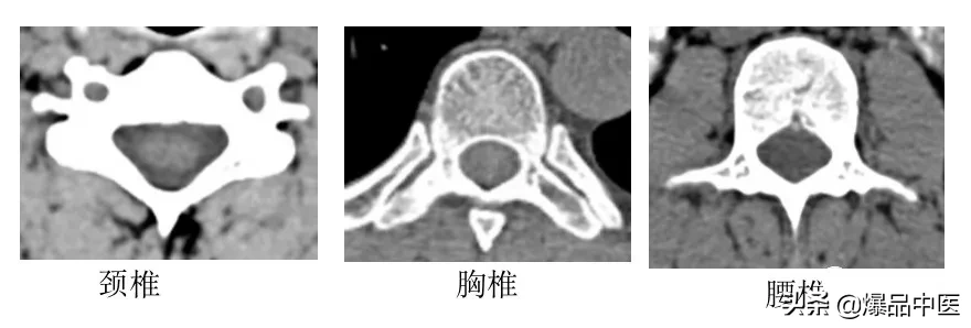收藏了：脊柱超详细解剖，高清图文版