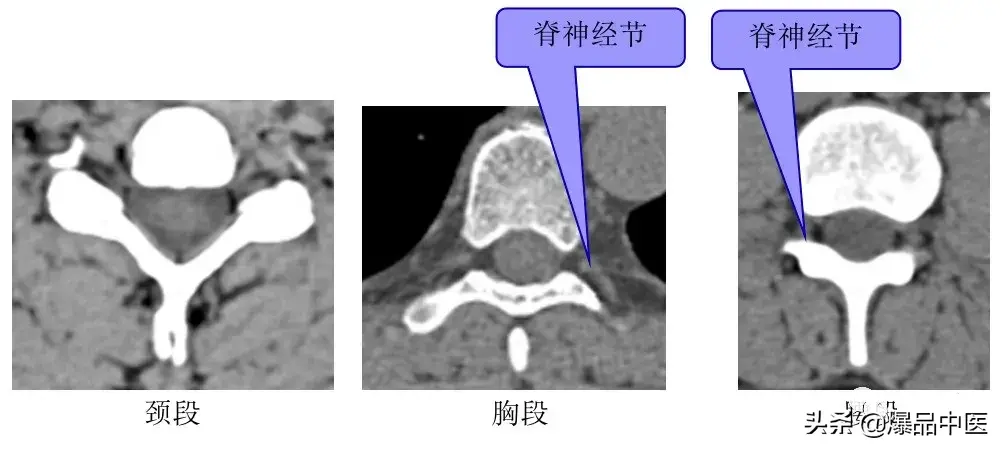 收藏了：脊柱超详细解剖，高清图文版