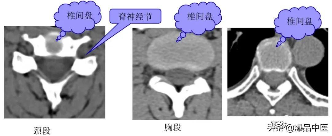 收藏了：脊柱超详细解剖，高清图文版