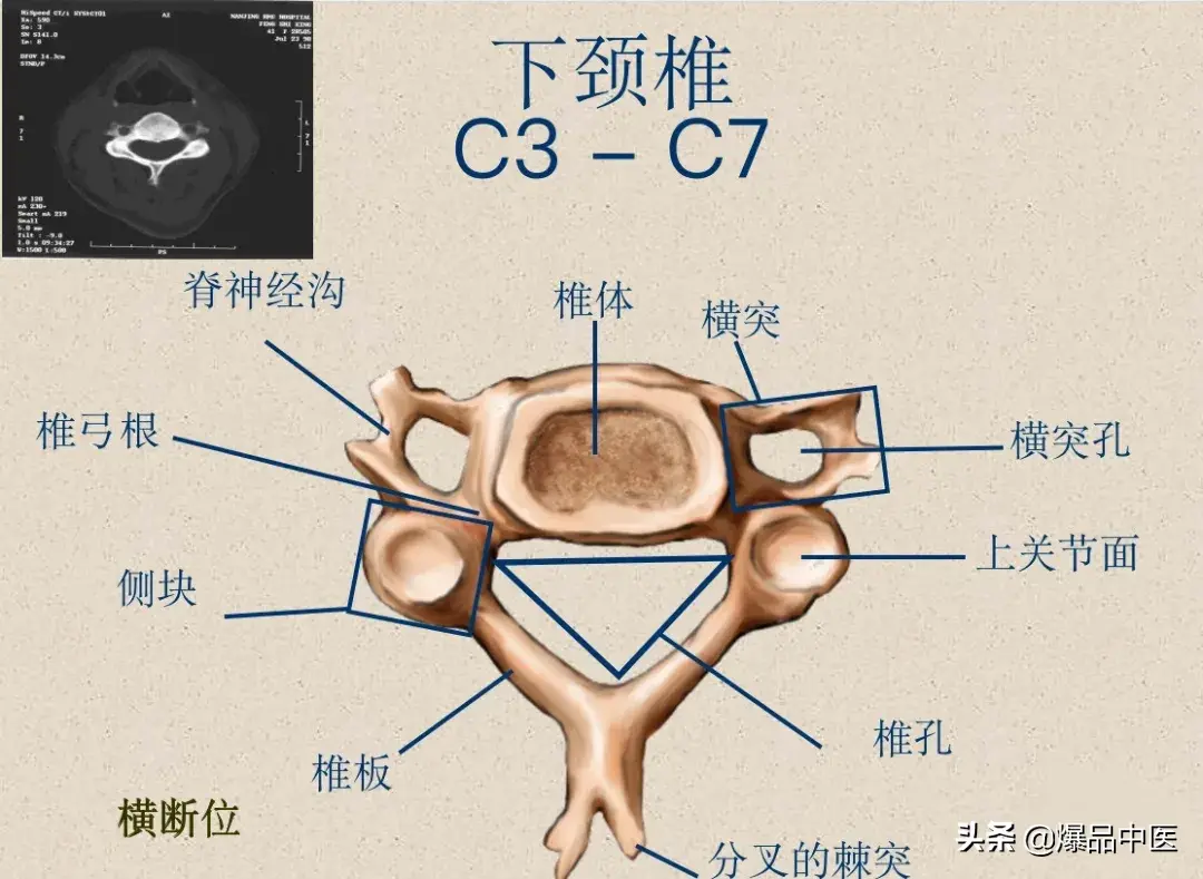 收藏了：脊柱超详细解剖，高清图文版