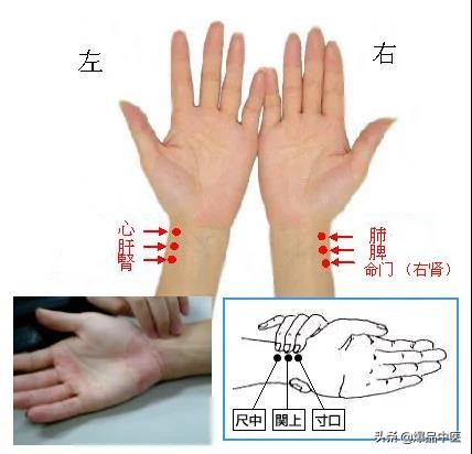 脉诊图画及脉歌,太珍贵了