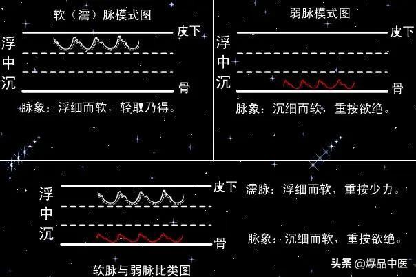 脉诊图画及脉歌,太珍贵了