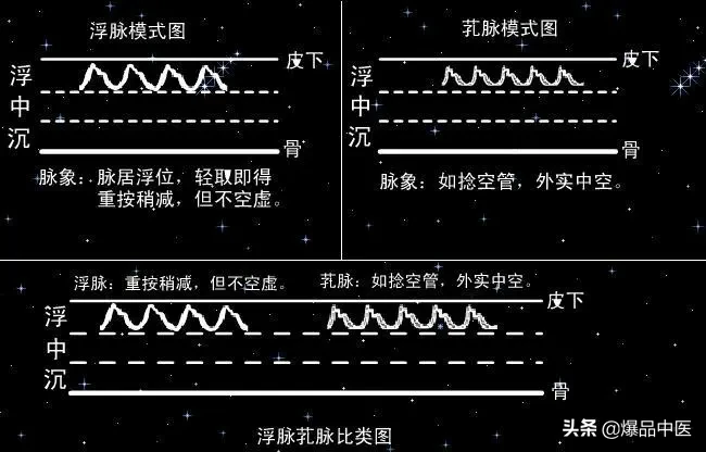 脉诊图画及脉歌,太珍贵了