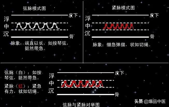 脉诊图画及脉歌,太珍贵了