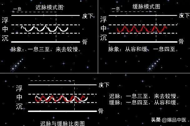脉诊图画及脉歌,太珍贵了