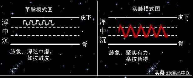 脉诊图画及脉歌,太珍贵了