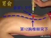 上病下治：18个上下对应而效用神奇的穴位