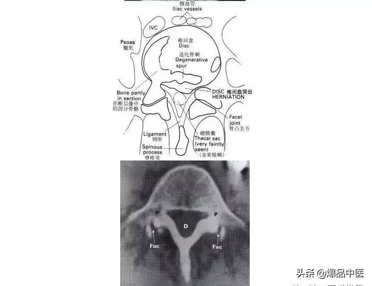 详细的脊柱腰段解剖图