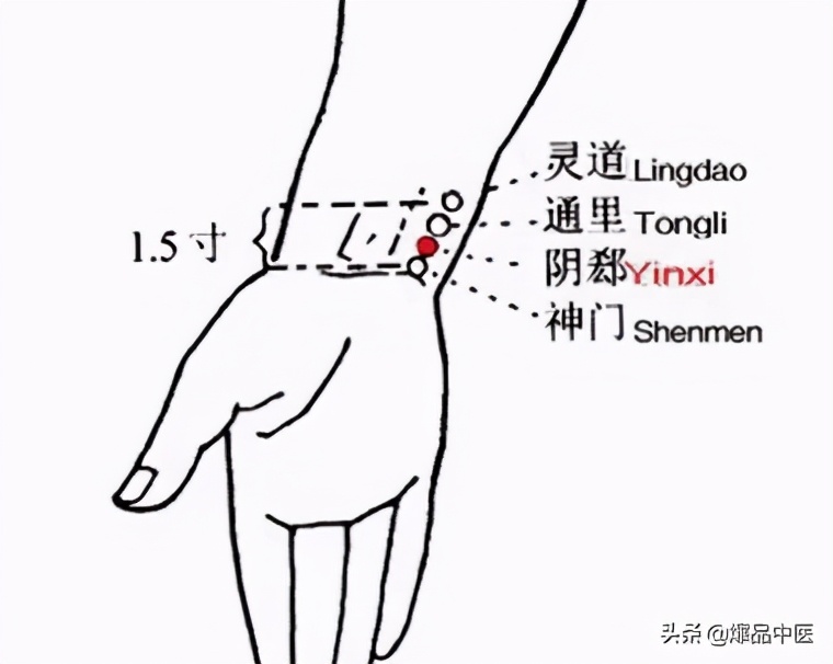 牢记全身疾病特效穴，专穴专用