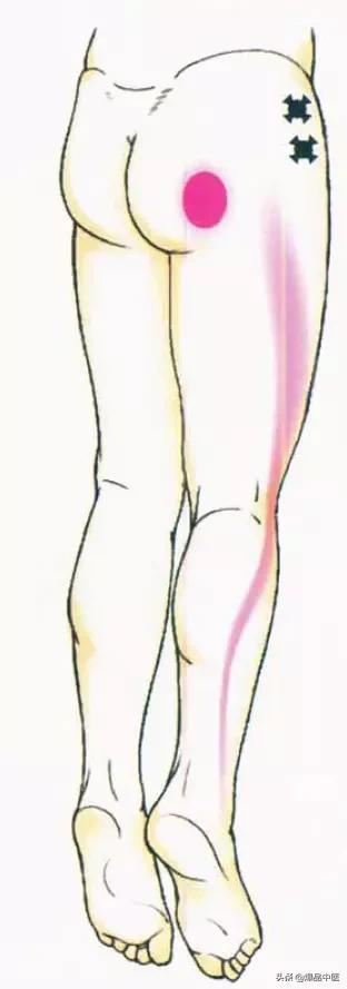 最全膝关节疼痛分析与临床「干货」