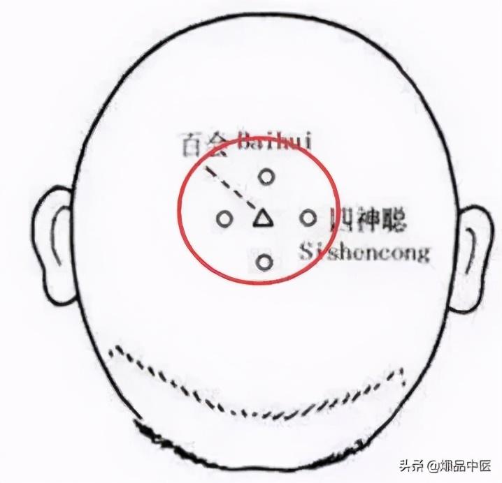 手上有四个穴位，可治疗一切头疼