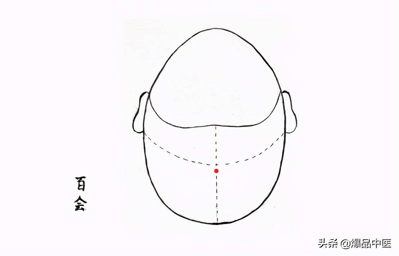 针灸急救，被淡忘的最好急救术