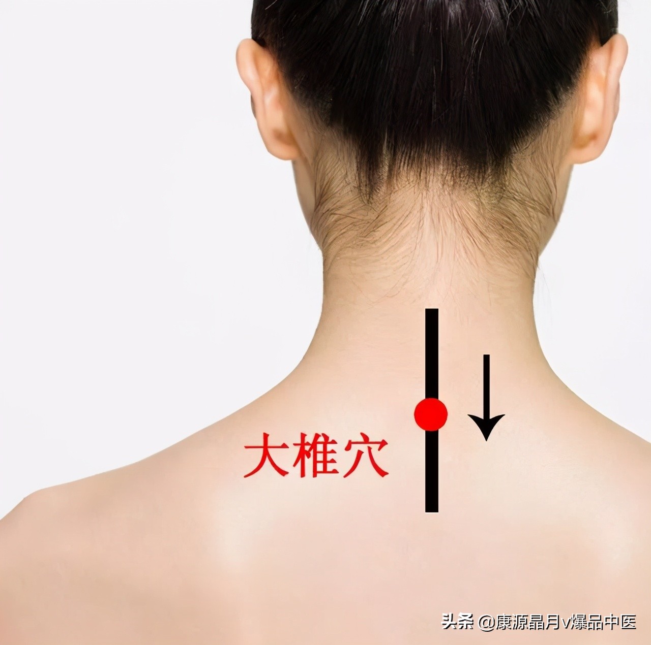 大椎穴——身体的小太阳