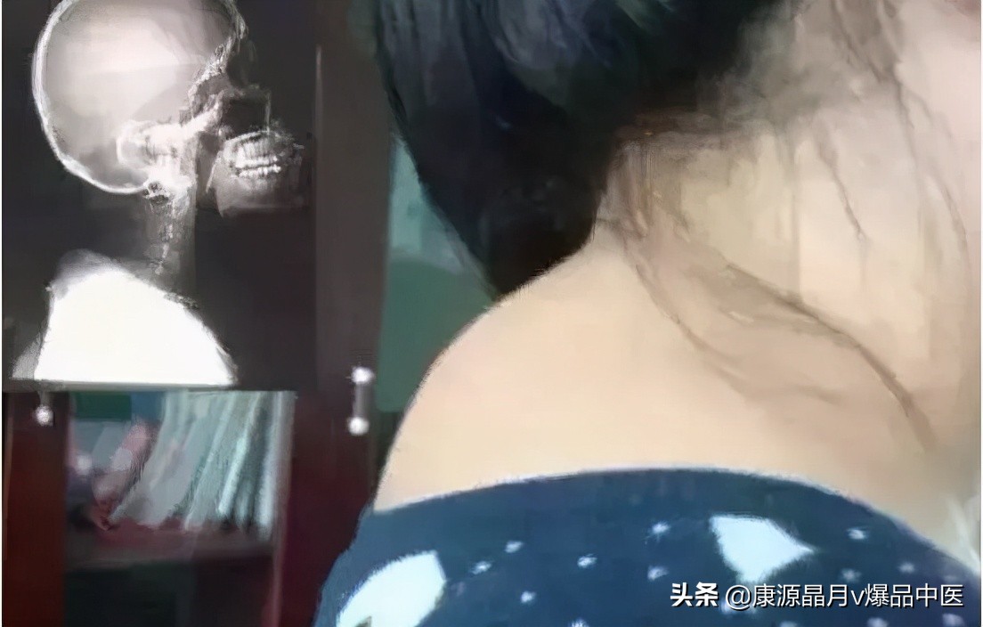 大椎穴——身体的小太阳