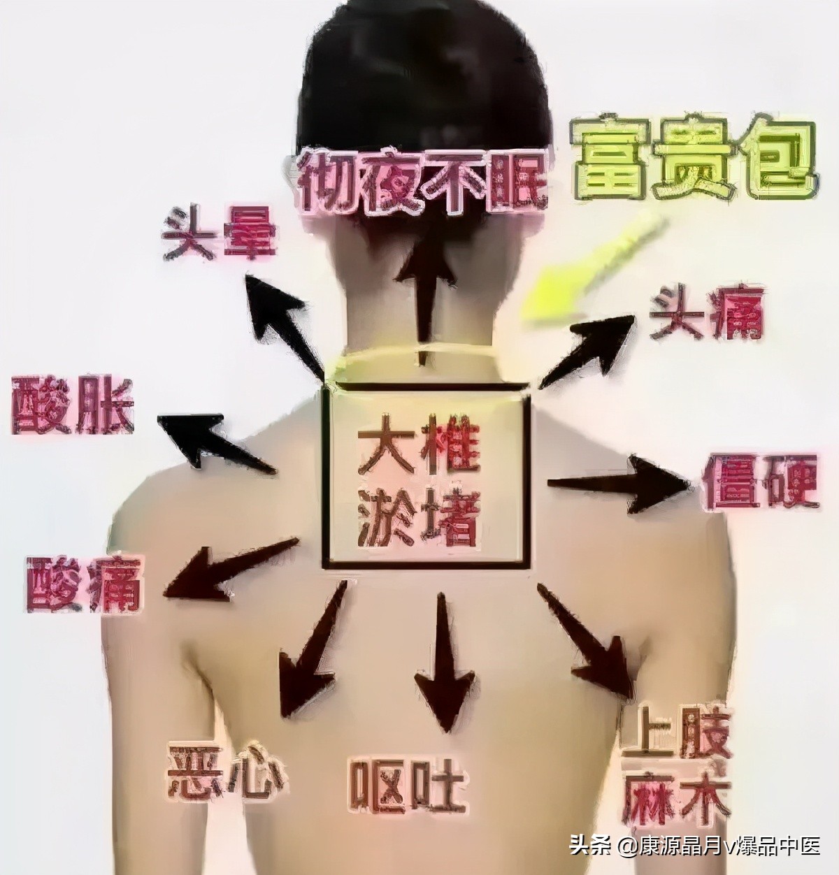 大椎穴——身体的小太阳