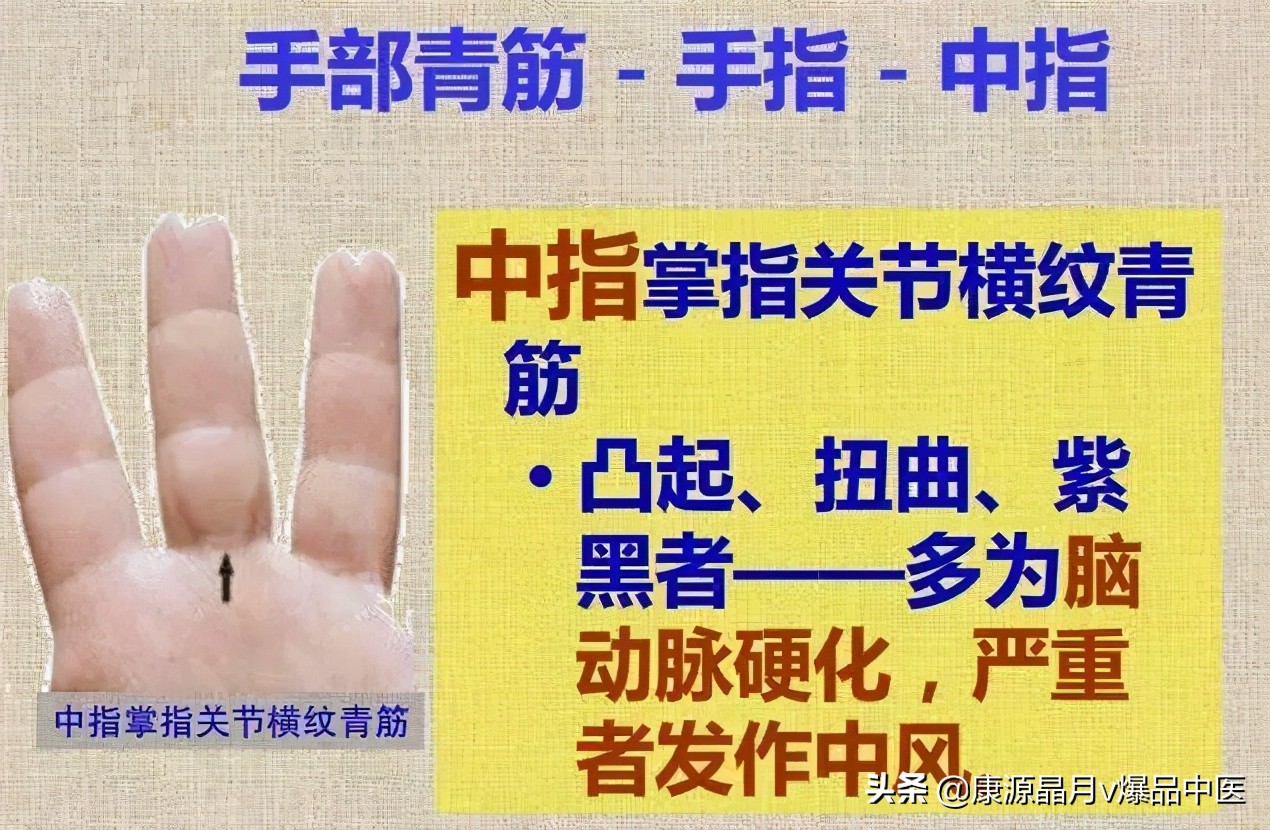 这个部位长青筋，非死即残