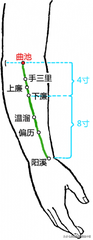 各种痛症的针灸治疗大全