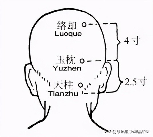 各种痛症的针灸治疗大全