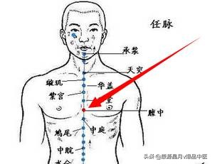 各种痛症的针灸治疗大全