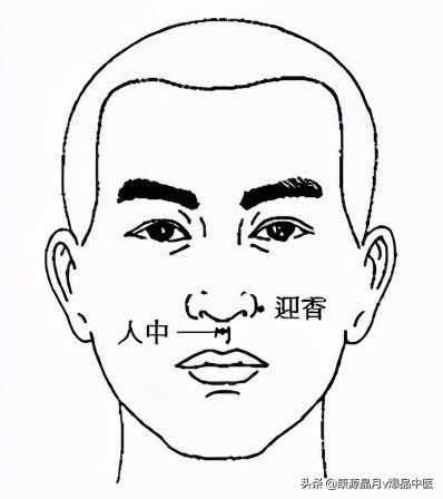 各种痛症的针灸治疗大全