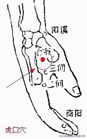 各种痛症的针灸治疗大全