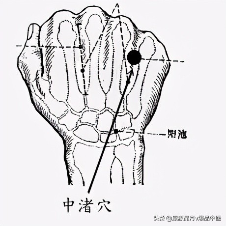 各种痛症的针灸治疗大全